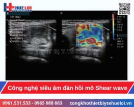 máy siêu âm Doppler màu 5D