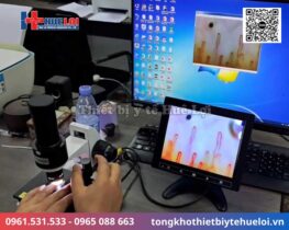 kính hiển vi soi mạch máu