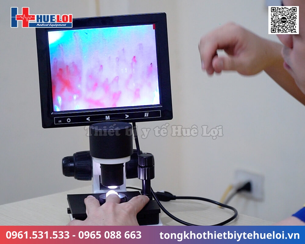 Kính hiển vi soi mạch máu XW880 độ phóng đại 400 lần | Huê Lợi 32 máy soi mạch máu