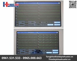 Máy điện tim 6 kênh Contec-600G | Màn hình cảm ứng 14 máy điện tâm đồ