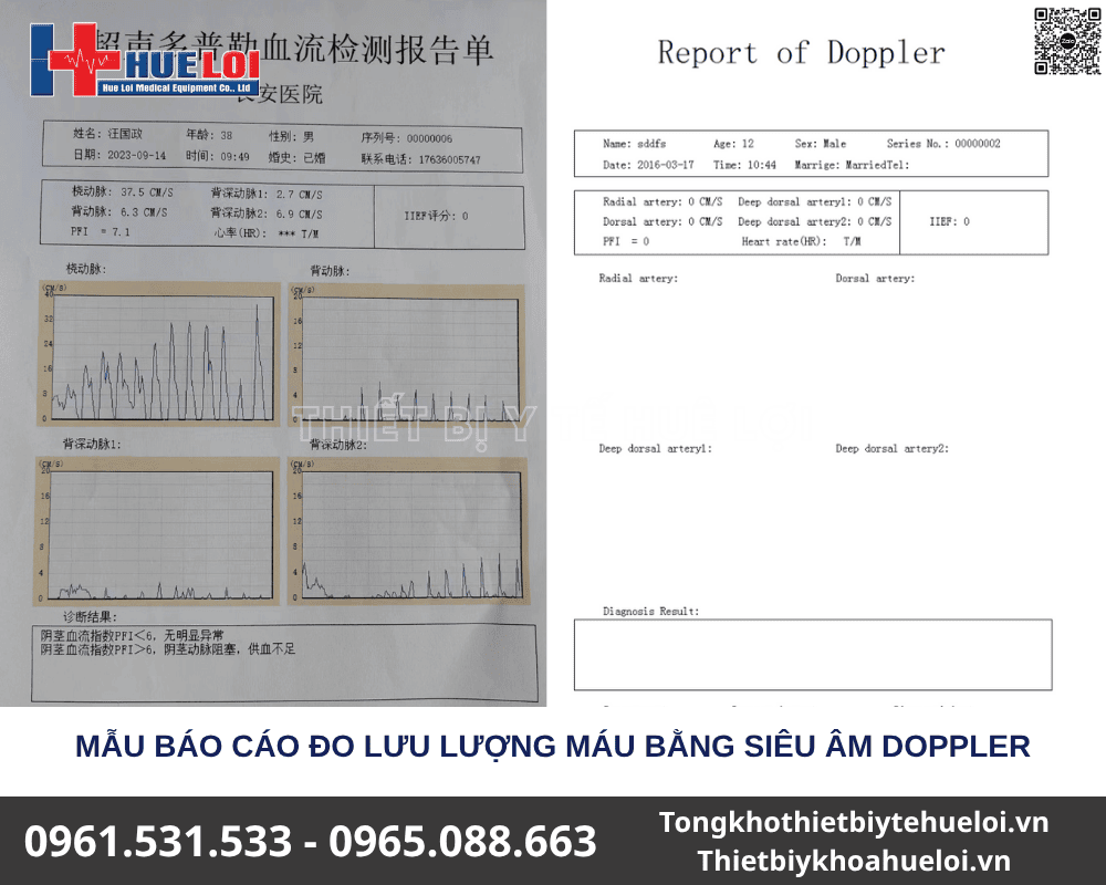Máy Chẩn Đoán Rối Loạn Chức Năng Tình Dục Nam Giới – Thiết Bị Nam Khoa Toàn Diện 2 máy kiểm tra yếu sinh lý