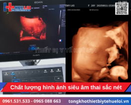 máy siêu âm Doppler màu 5D
