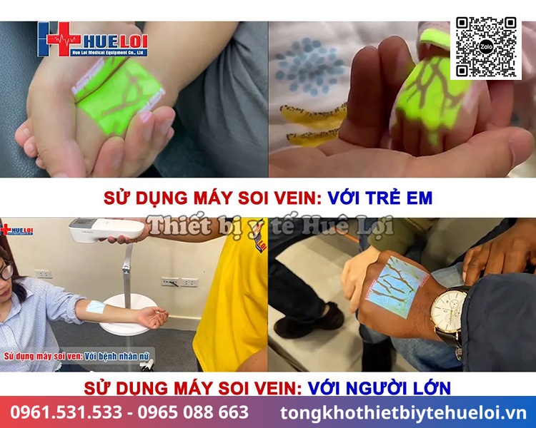 Máy tìm tĩnh mạch QV-600 | Giải pháp lấy ven chính xác 15 thiết bị hỗ trợ lấy ven