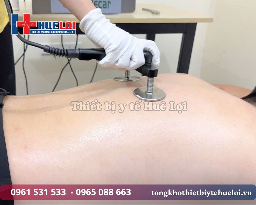 trị liệu cơ xương khớp