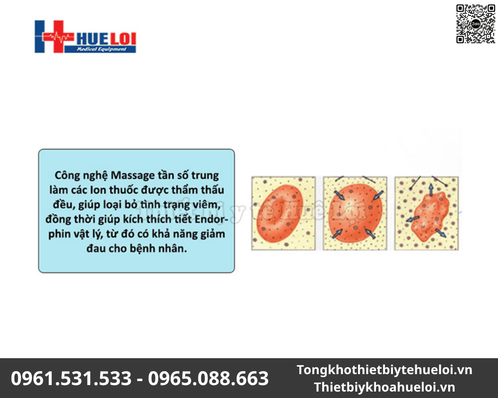 trị liệu tuyến tiền liệt sanwe