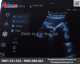 chất lượng hình ảnh siêu âm