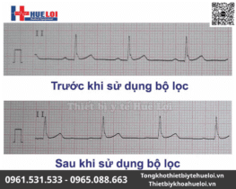 Máy điện tim 6 kênh Contec-600G | Màn hình cảm ứng 12 điện tim đồ
