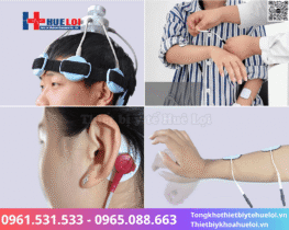 máy kích thích điện từ trường xuyên sọ